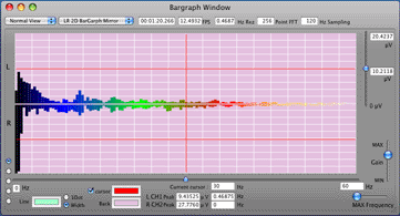 Enlarge 2D Bar Graph Window